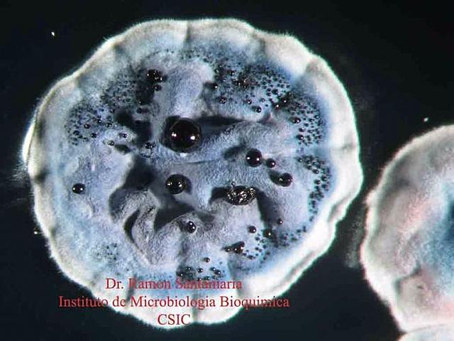 Vibrio cholerae cromosomas