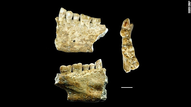 Antigua reparación dental de primera instancia