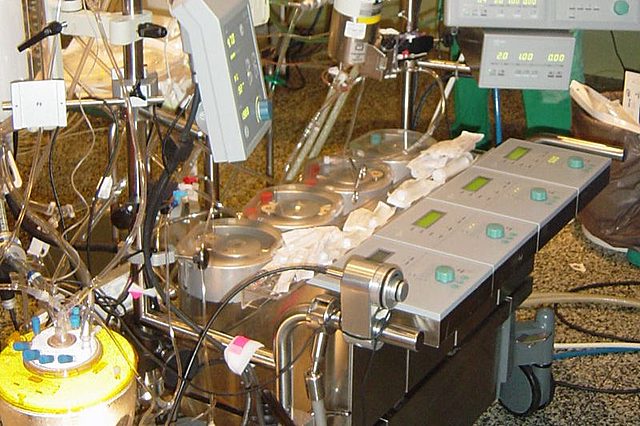 circulacion extracorporea