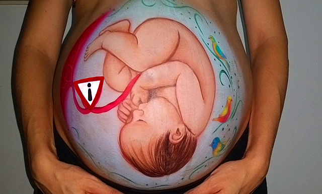 Uso de ciprofloxacina por mujeres embarazadas y lactantes