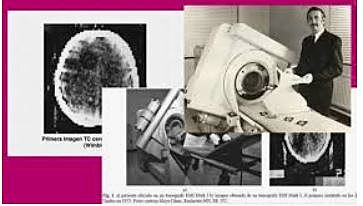 Primer scaner craneal