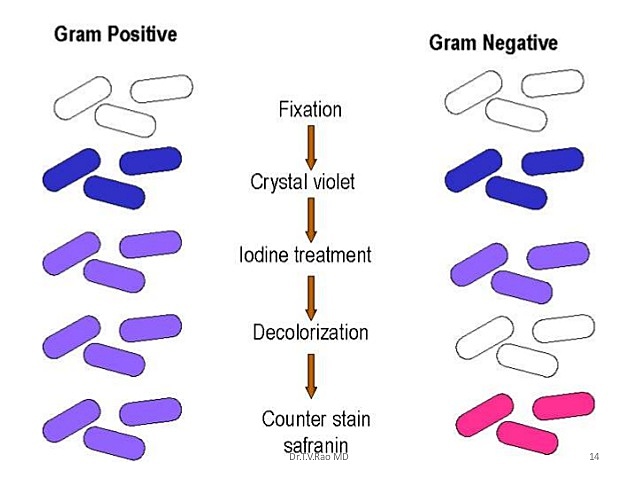 Tinción de bacterias