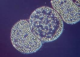 Descubrimiento de thiomargarita namihiensis ,la bacteria mas grande del mundo