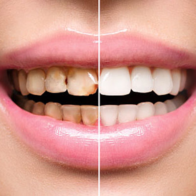Timeline: Evolución de la odontología restauradora