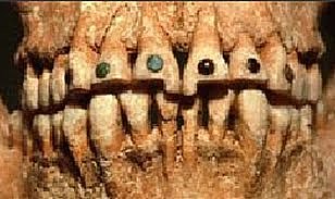 Primeras restauraciones en Mesopotamia