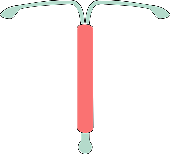 Origen del dispositivo intrauterino