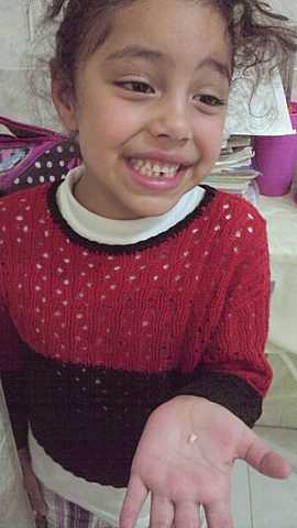 Mi primera caida de diente