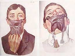 Llega el dique de goma