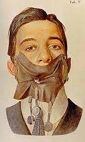 Descubrimiento del dique de goma