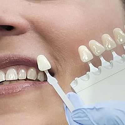Timeline: Evolución de la odontología restauradora