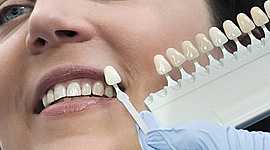 Timeline: Evolución de la odontología restauradora