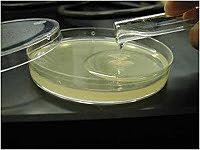 Hidrocoloide reversible (material indirecto)