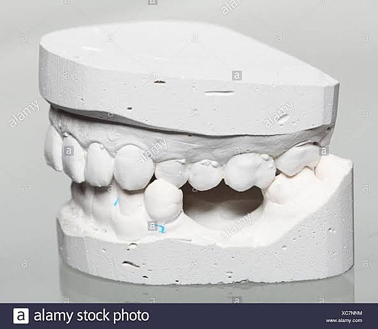 Yeso (material indirecto)