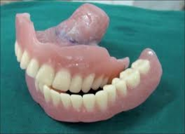 Ammaji's denture