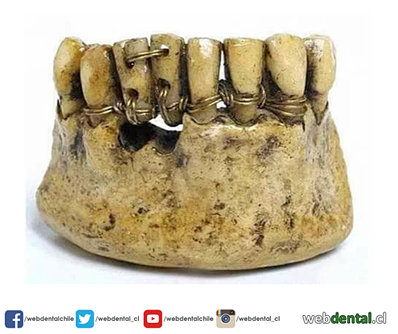Desarrollo de la Protesis Dental