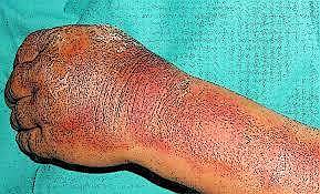 Adoptan medidas preventivas eficaces