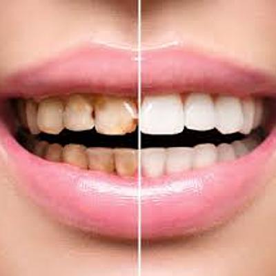 Timeline: Evolución de la Odontología Restauradora hasta la actualidad