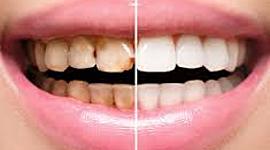 Timeline: Evolución de la Odontología Restauradora hasta la actualidad