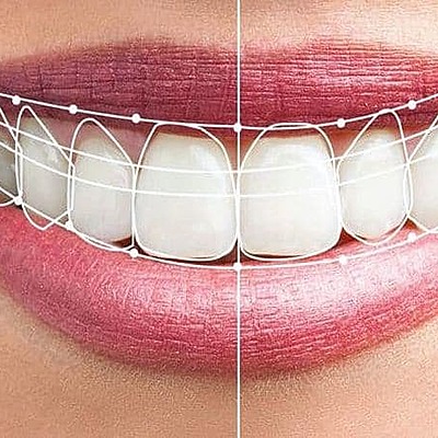 Timeline: Evolución Odontología Restauradora