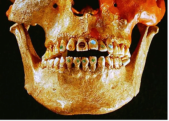 Odontología egipcia