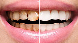 Timeline: Odontología restauradora