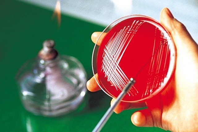 Nacimiento de la microbiologia