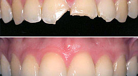 Timeline: Conocer la evolución de la Odontología Restauradora hasta la actualidad