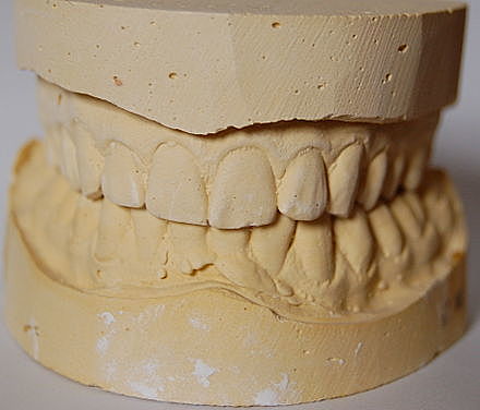 Hidrocoloides reversibles