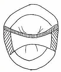 Principios de preparación cavitaria