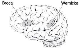 Wernicke