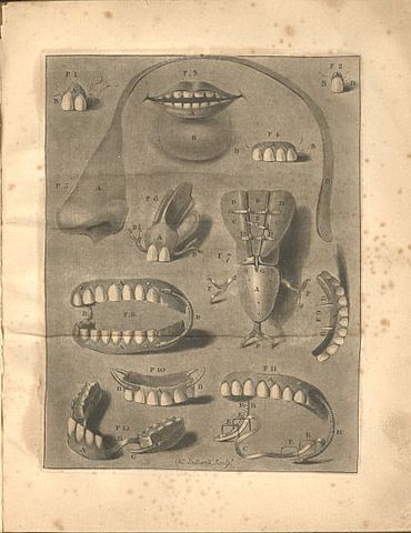 Se patenta el primer diente de porcelana