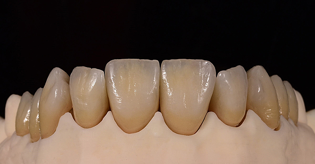 Introducción de la cerámica