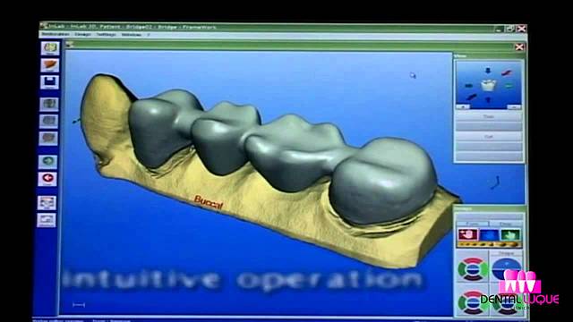 Sistema Cerec inLab MC XL CAD / CAM