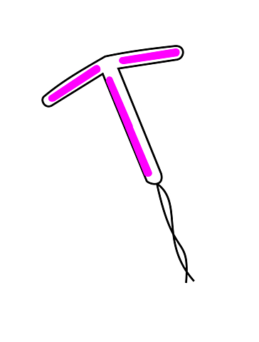 Dispositivo intrauterino