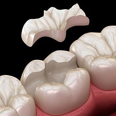 Timeline: ODONTOLOGIA RESTAURADORA