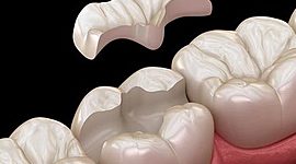 Timeline: ODONTOLOGIA RESTAURADORA