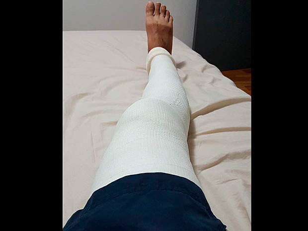 Em trenco el ligament del genoll