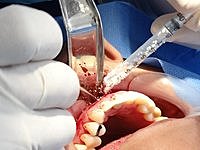 El libro de texto "Operative Dentistry ” incluía cirugía oral, prostodoncia fija y odontología operatoria.