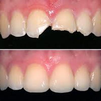 Timeline: JESÚS ZAVALA Y LA ODONTOLOGÍA RESTAURADORA