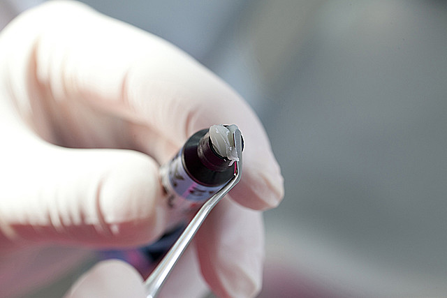 Refinamientos y mejoras en la calidad de varios materiales y procesos utilizados en la odontología restauradora.