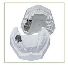 Aleaciones en bronce.