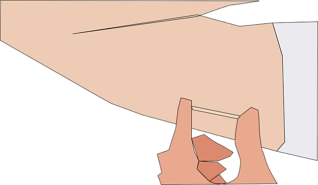 Implantes Subdermico