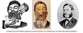 El Dr. Sanford C. Barnum bendijo el campo de la odontología quirúrgica con su descubrimiento del dique de goma.