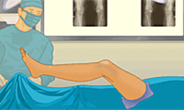 me realizaron la 1 cirujia de la rodilla!!