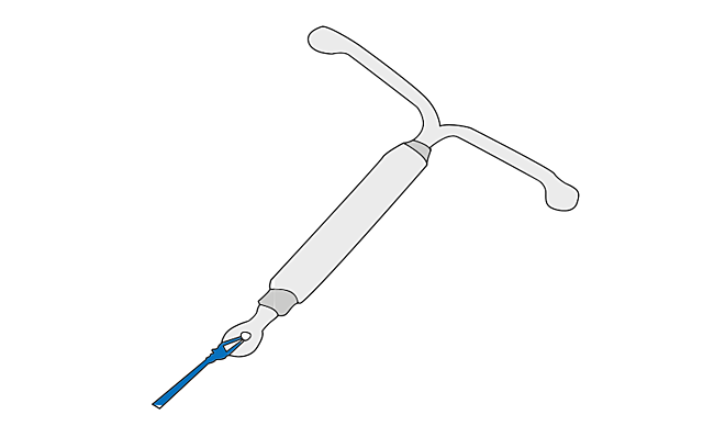 Sistema Intrauterino