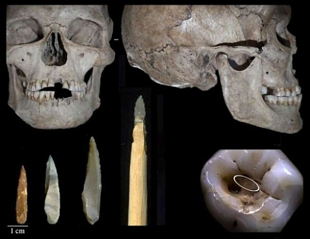Instrumentos para preparación