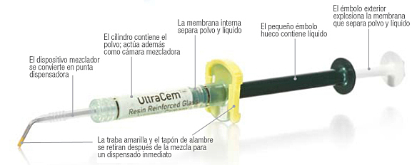 Antonucci et al. introduce los Ionómeros de vidrio modificado con resina