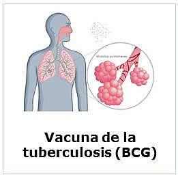 La vacunación con BCG contra la tuberculosis.
