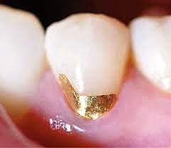 LÁMINA DE ORO COHESIVA