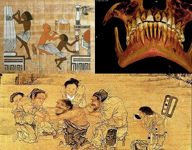 Primeros indicios de la Odontologia Restauradora